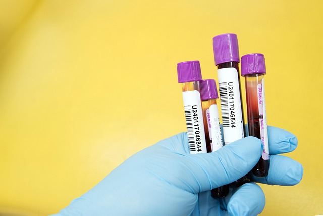 MEDITECH DIAGNOSTICS COLLECTION CENTER in Bangalore