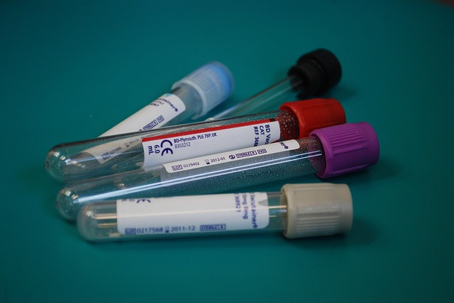 Thyrocare in Bangalore